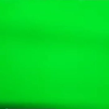 Samsung 65QN70F UHD Smart Neo QLED TV 2 Ay Sonra Bozuldu