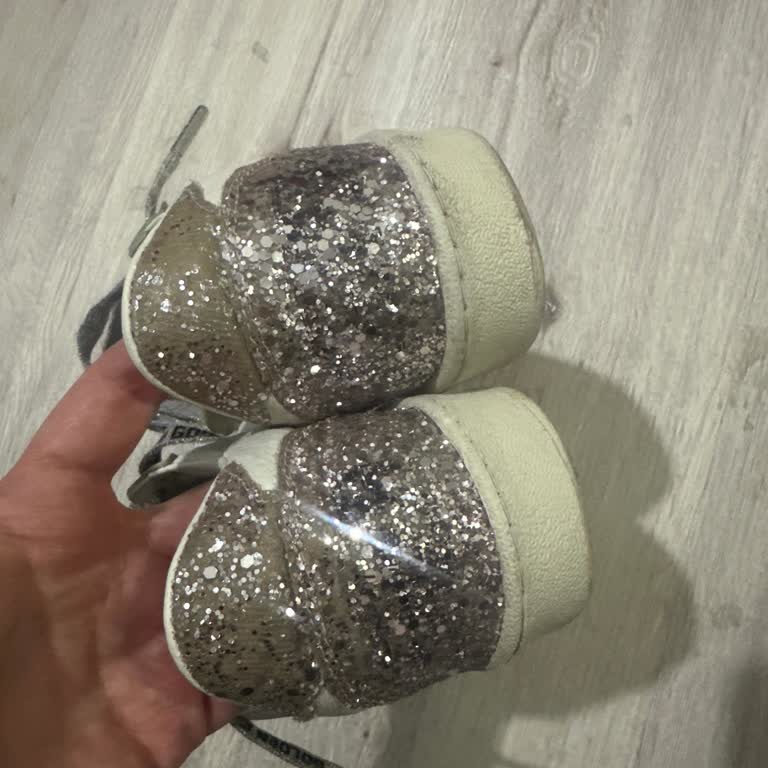 Golden Goose Ayakkabılarım Bakımda Zarar Gördü Ve 9.000 TL’lik Ödeme Boşa Gitti