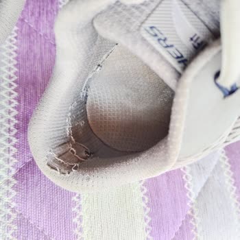 Skechers Ayakkabısının Erken Deformasyonu Ve Yırtığı: Ücretsiz Değişim Talebi