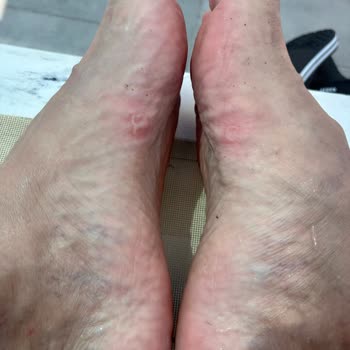Deichmann’dan Aldığım Cross Ayakkabı Üç Günde Ayağımı Yara Yaptı: İade İstiyorum