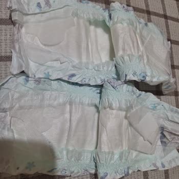 Aynı Bebek Bezi Ürünün Farklı Partilerinde Kalite Düşüşü Ve Cilt Tahrişi