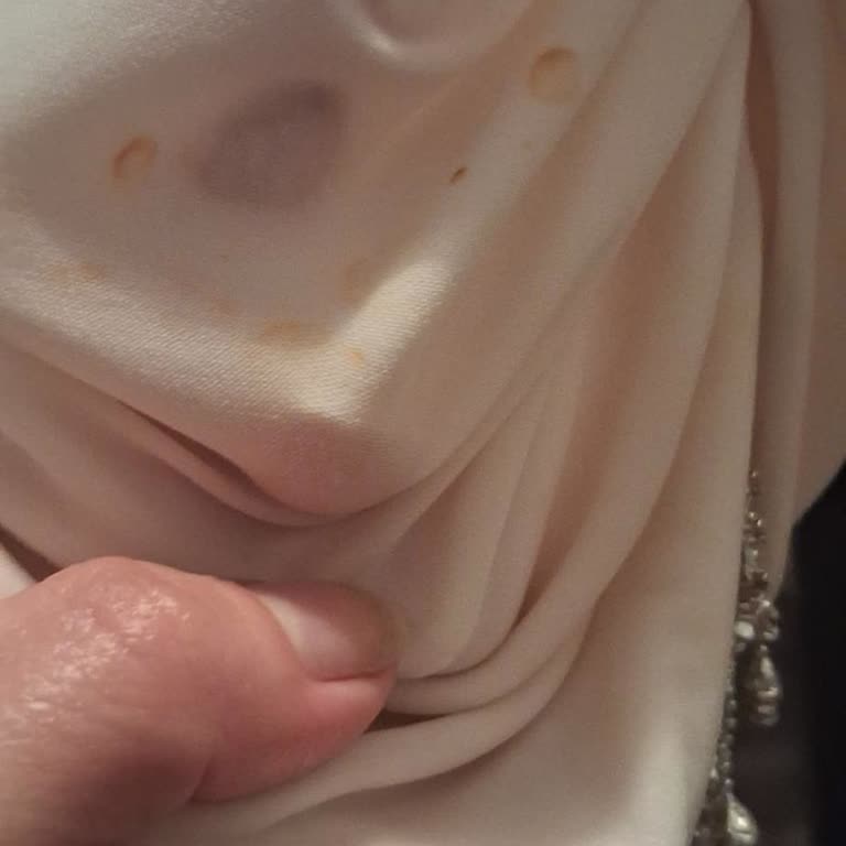 Tesettür Bonede Yıkama Sonrası Sarı Lekeler Ve Ücret İadesi Talebi