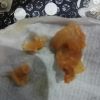 Hot Döner Bolu Caddesi Şubesinde Tavuk Dönerde Kıkırdak Parçası Tespit Edildi