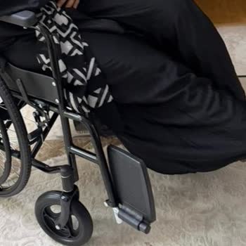 A101 Şubesinde Palet Ve Köpek Nedeniyle Yaşadığım Düşüş Ve Bilek Kırığı, Maddi Ve Manevi Tazminat