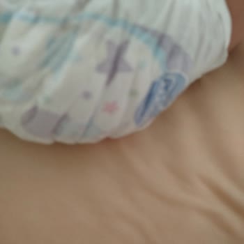 Molfix Bebek Bezi Sızdırma Sorunu Oğlumda Memnuniyetsizliğe Neden Oldu