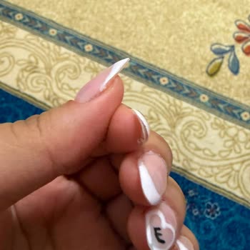 Protez Tırnaklar 24 Saat İçinde Çıktı, Salon İade Ve Düzeltme Reddetti