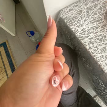Protez Tırnaklar 24 Saat İçinde Çıktı, Salon İade Ve Düzeltme Reddetti