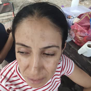 Enza Beauty Center’da Zorla Ürün Satışı Ve Gerçekleşmeyen Sonuçlar