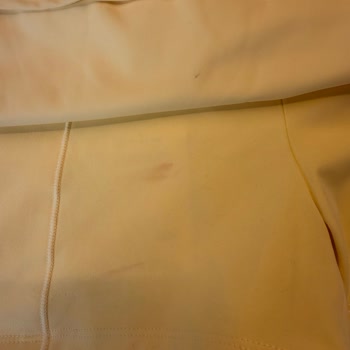 Teslim Edilen Etek Lekeli Ve Hijyenik Olmayan, Acil Değişim Talebi