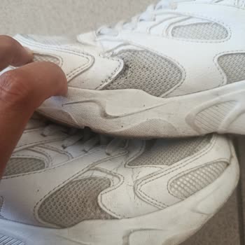 Skechers Ayakkabıda Tek Tek Patlama, Mağaza Yokluğunda İade Sorunu