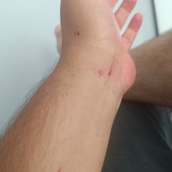 İnce Camlı Duş Kabini Patladı Ve Yaralanmaya Neden Oldu, Hepsiburada Yanıt Vermedi
