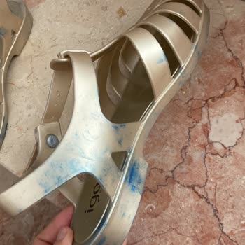 İgor Sandalette Renk Bozulması Ve Çözüm Sunulmayan İade Süreci