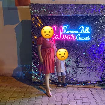 İgor Sandalette Renk Bozulması Ve Çözüm Sunulmayan İade Süreci