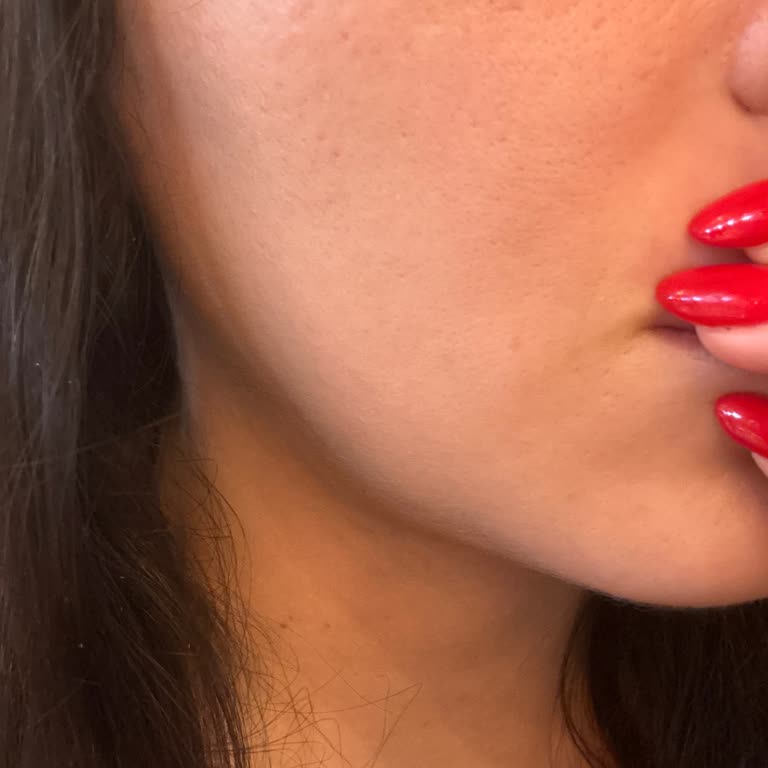 Hydrafacial’da Siyah Nokta Ve Yağ Bezi Temizliği Yapılmadı