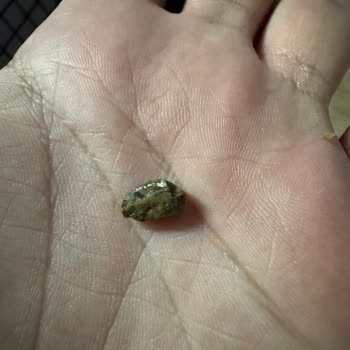 Çiğ Köfte Ürününde Taş Parçası Bulunması Ve Diş Kırılması