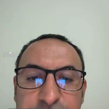 Superonline Modemin Ve Kabloların Eski Olması