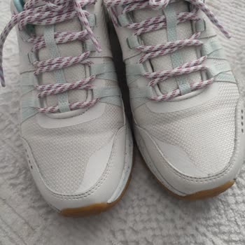 Skechers Ayakkabısının Tabandaki Çökme Ve Uzun İnceleme Sürecindeki İhmal
