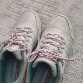 Skechers Ayakkabısının Tabandaki Çökme Ve Uzun İnceleme Sürecindeki İhmal