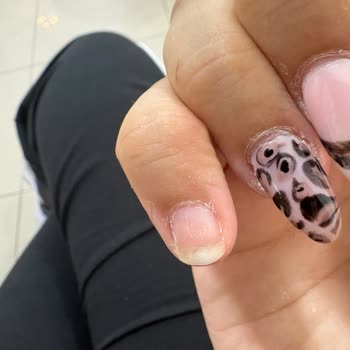 Akar Diamond’da Eksik Malzemeli Protez Tırnak, Erken Düşme Ve Çözüm Bulunamayan Şikayet