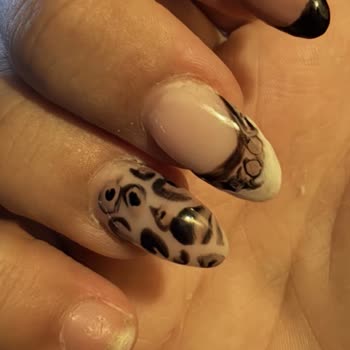 Akar Diamond’da Eksik Malzemeli Protez Tırnak, Erken Düşme Ve Çözüm Bulunamayan Şikayet