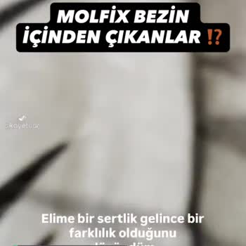Molfix 4 Numara Bezin İçinden Çıkan Şeyler Nedir?