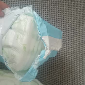 Molfix Bebek Bezinde Ürün Karışıklığı Güvenliği Sarsıyor