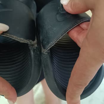 Deichmann Erkek Terliğinin Çift Kolunda Aynı Anda Yırtılma: Kalite Sorunu Ve Kullanıcı Hatası Reddi