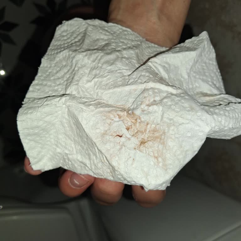 Kanama Halinde Eve Gönderilme Ve Doktorun Umursamaz Tutumu