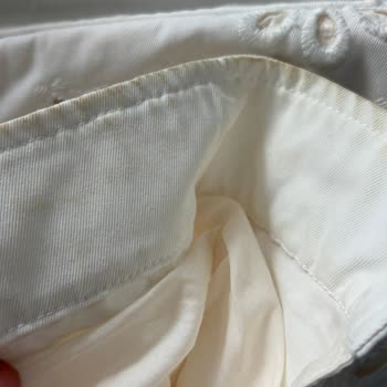 Zara Online Siparişimde Çöplerle Dolu Kullanılmış Ceket