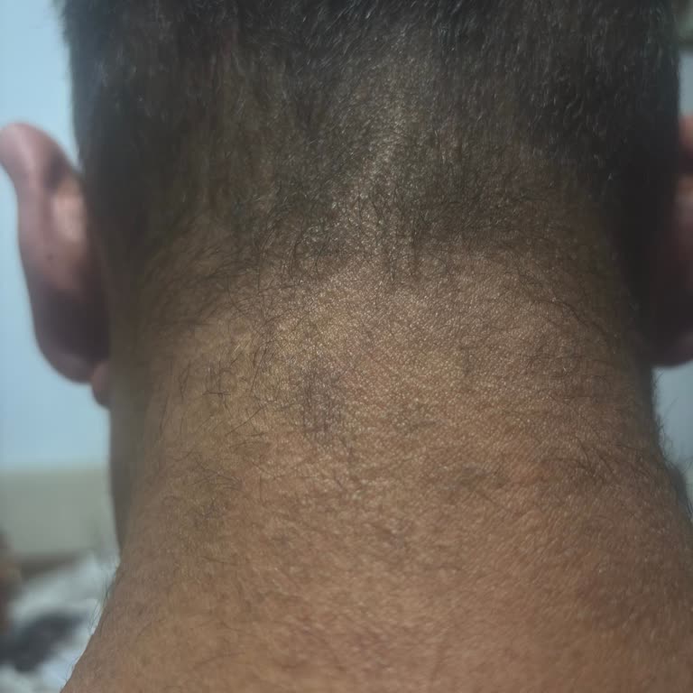 Esse Life Kayseri Lazer Epilasyon Seanslarının Etkin Olmaması ve Verilen Sözlerin Tutulmaması