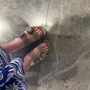 Birkenstock Arizona Terliği Kısa Sürede Yara Yaptı, İade Ve Değişim Talebi