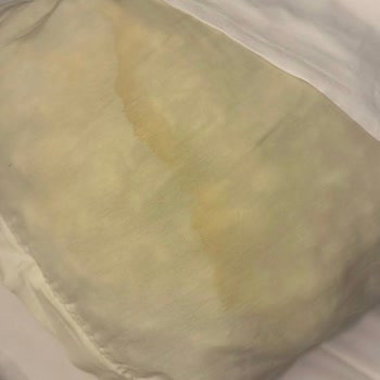 Jolly Tur’da Yanıltıcı Otel Görselleri Nedeniyle Rezervasyon İptali Ve Transfer İsteği