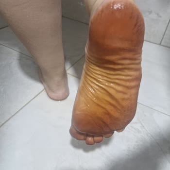 Süet Terlikte Renk Geçmesi, Cilt Tahrişi Ve Sağlık Riski