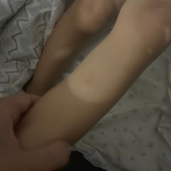 Bursa Büyükşehir Belediyesi Selçuk Mahallesinde Sinek Sorunu Artıyor, Acil İlaçlama Gerekiyor