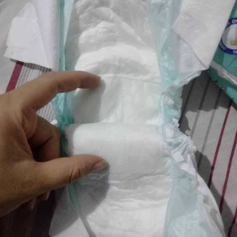 Jenny Willy 3 Numaralı Bebek Bezinde Çiş Çekmemesi Ve Pişik Sorunu