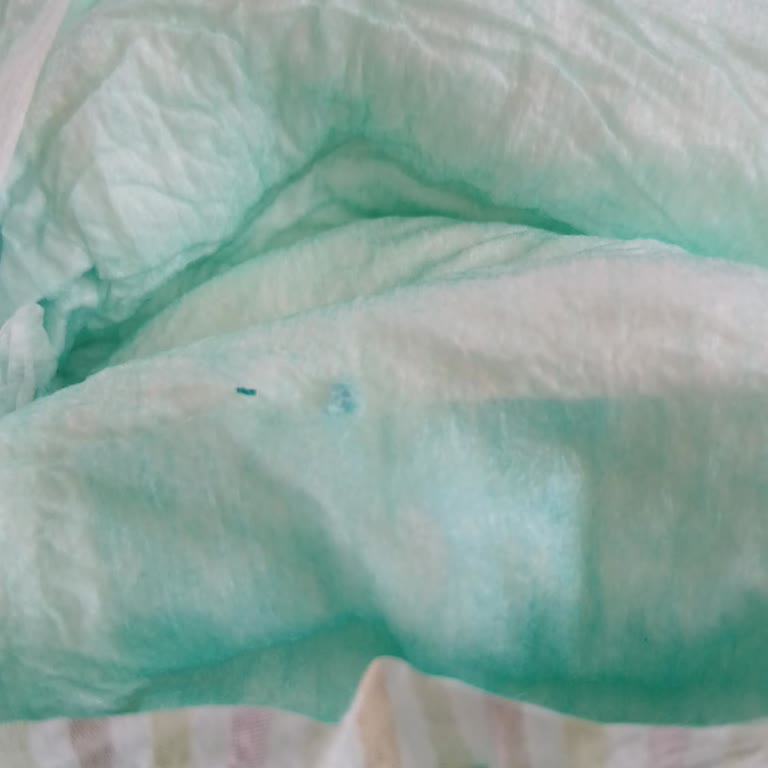 A101 Soffia Bebek Bezinde Plastik Parçalar Bulundu
