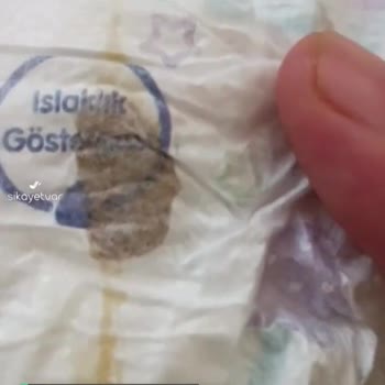 Molfix Garip, Lekeli, Hatalı Ürün
