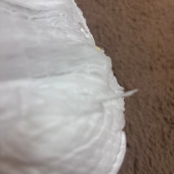 Molfix Bebek Bezinde Sert Ve Sivri Yabancı Cisim Bebek Güvenliğini Tehdit Ediyor