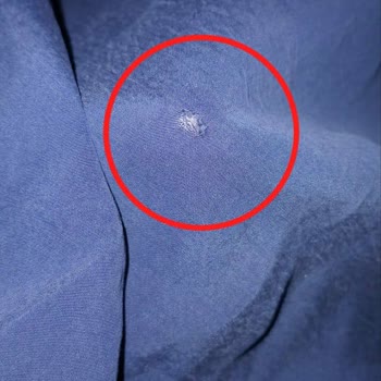 Defolu Tunikler Nedeniyle Mağdur Oldum Koşulsuz İade Talebim Reddedildi