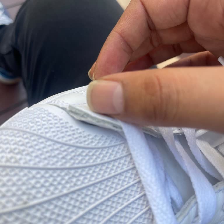 Adidas Superstar Ayakkabısında Kısa Sürede Açılma Ve Mağaza Güvencesinin Bozulması