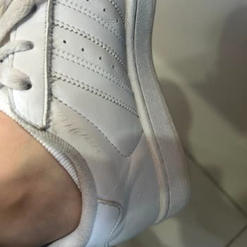 Adidas Superstar Ayakkabısında 2 Ayda Kırılma Ve Boyner'in Müşteri Kaynaklı İddiası