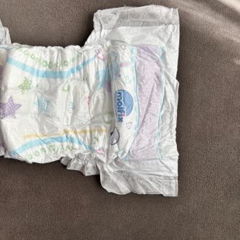 Molfix Bebek Bezinde Tasarım Değişikliği Ve Ölçü Farkı