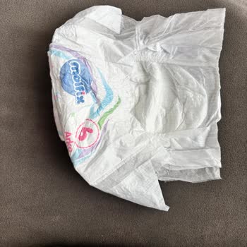 Molfix Bebek Bezinde Tasarım Değişikliği Ve Ölçü Farkı