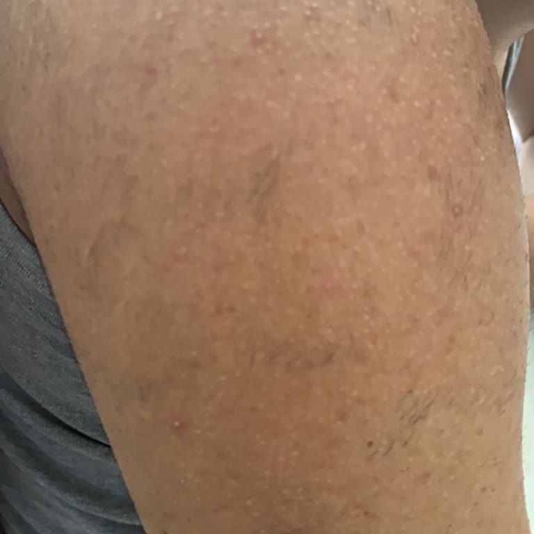 Erkek Estetisyen Sözünün İhlali Ve Saygısız Çalışan Davranışı