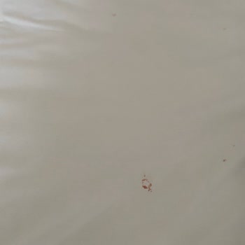 Garden Of Sun Otel Hijyen Skandalı: ETS Tur’dan İade Talebi