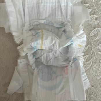 Molfix Maxi 4 Numaralı Bebek Bezinde Boş İç Kısım Hatası