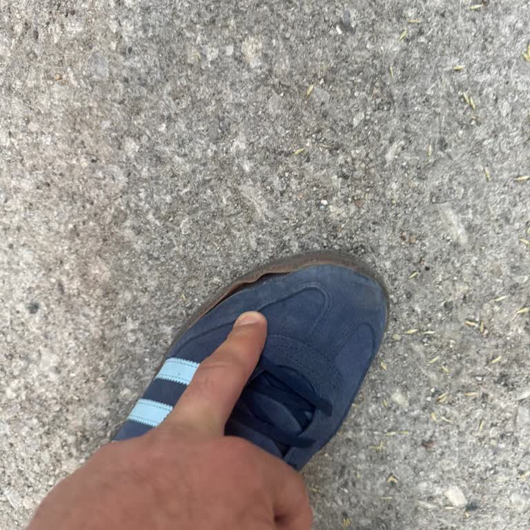 Sneaks Up Şubesinde Ayakkabı Ön Tabanı Kopması Ve Fatura Gönderilmemesi