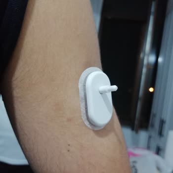 Arızalı GS1 Sensörleri Nedeniyle Ölçüm Yapamama Ve Ücretsiz Değişim Talebi