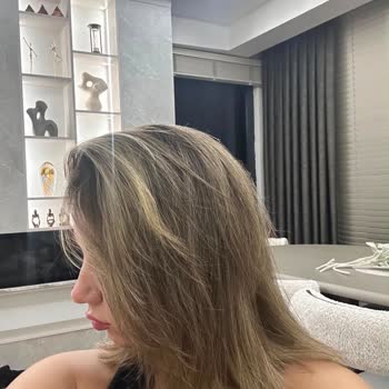Haydar Güneş Hair Palace Görüntü Olarak ve  Saç Sağlığı Açısından Hayal Kırıklığı Yaşadım