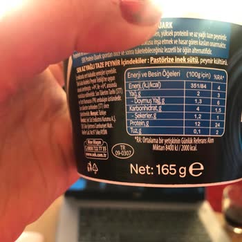 A101 Şubesinde Üründe Kıl Bulunması Ve Hijyen İhmaline Karşı İade Talebi